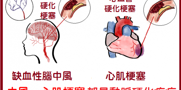(3)可以一眼看出那些人是心肌梗塞的高危險群嗎?